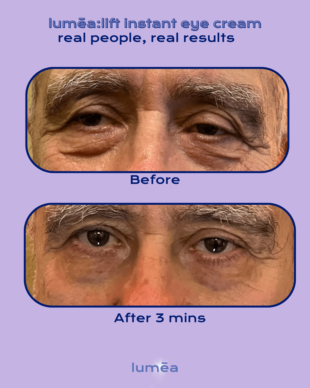 lumēa:lift cream - lumēa
